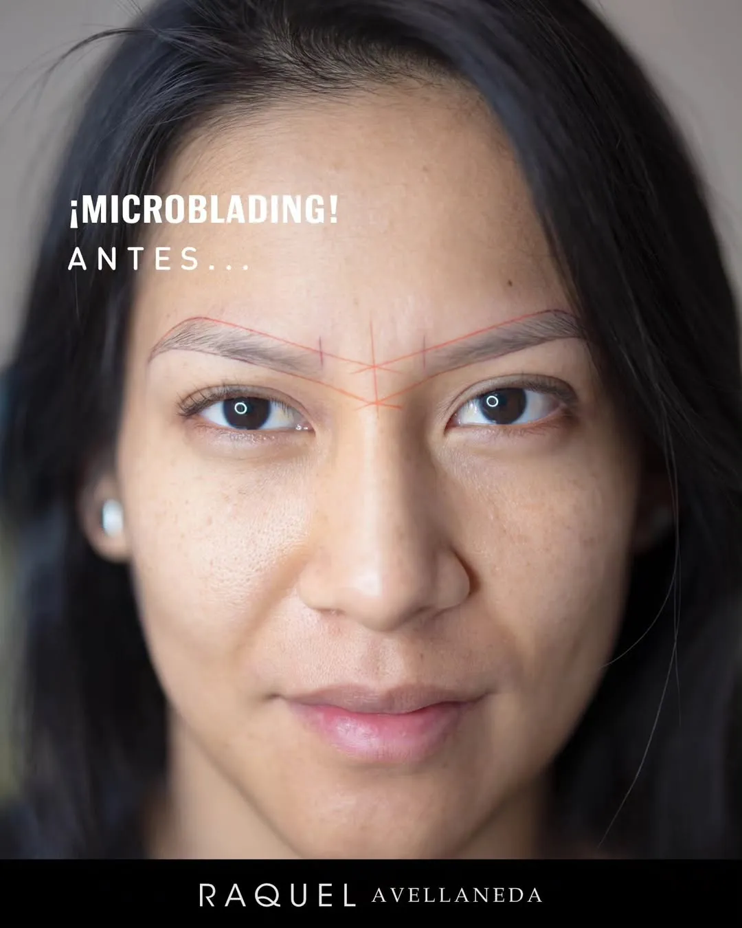 Caso 01 · Microblading antes
