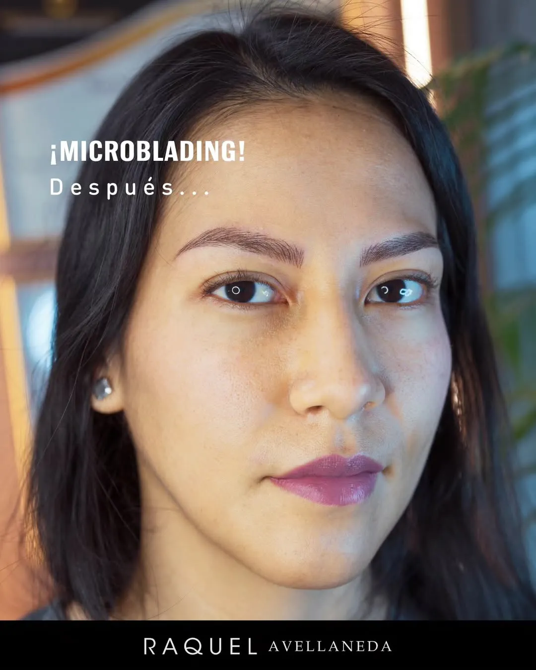 Caso 01 · Microblading después