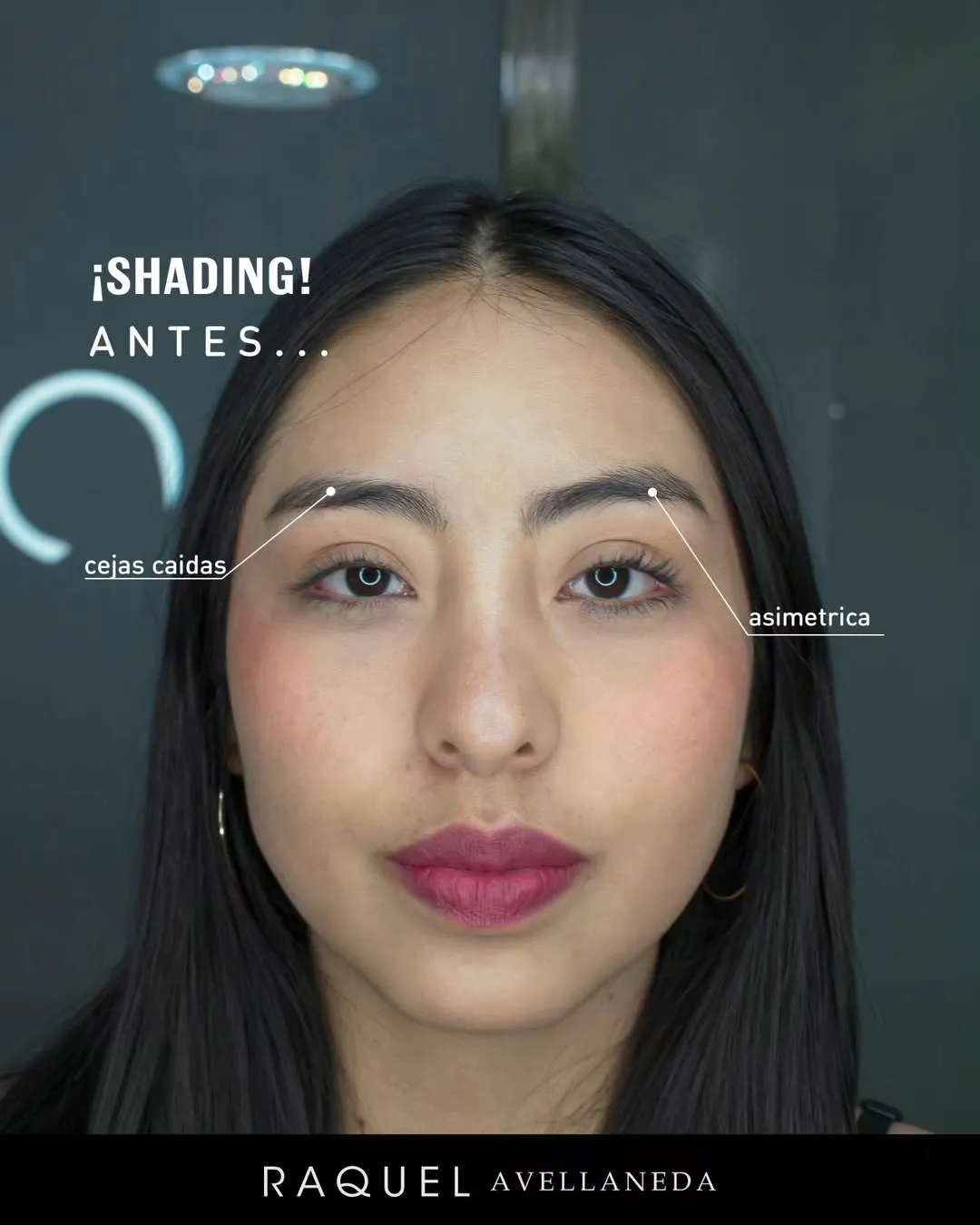 Caso 03 · Shading antes