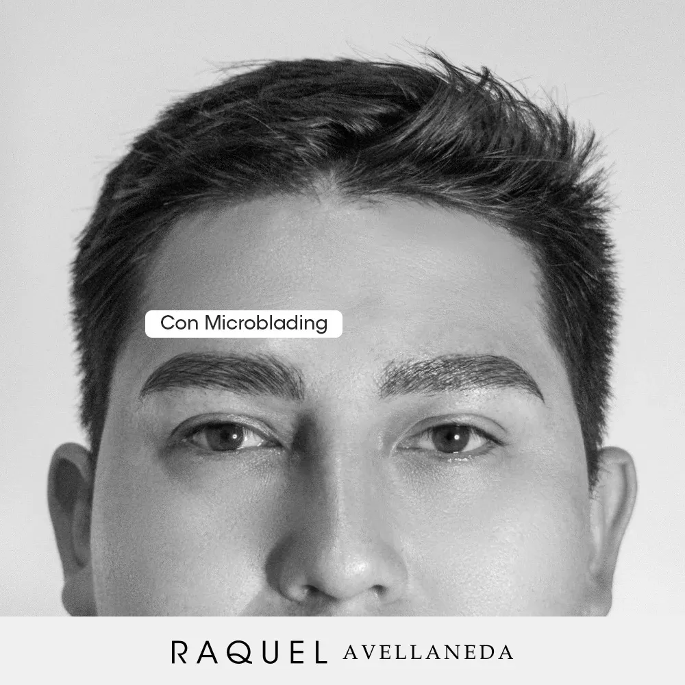 Caso 02 · Microblading masculino después